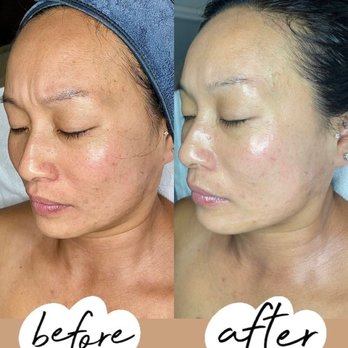Elevated Esthetics CO - Eyelash Service Near Me - Thornton, Colorado Elevated Esthetics CO - Eyelash Service Near Me - Thornton, Colorado