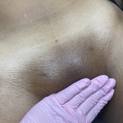 The Serial Waxer Co. - Brazilian wax every 5 weeks with proper aftercare.