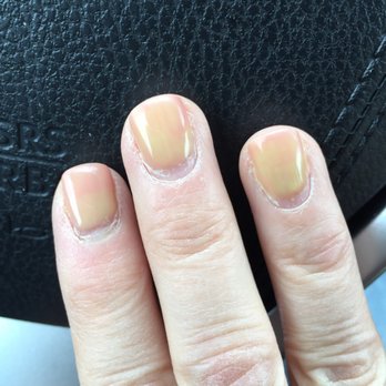 Glitter & Polish Nail Spa - It looks like I have an illness. DO NOT RECOMMEND THIS PLACE!!!! - Waxing Near Me - Paoli, Pennsylvania Glitter & Polish Nail Spa - It looks like I have an illness. DO NOT RECOMMEND THIS PLACE!!!! - Waxing Near Me - Paoli, Pennsylvania
