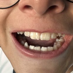 Zak Dental - Simi Valley