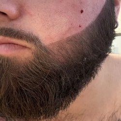 Cut Nice - Cheek cut open, freakishly tinted beard.
