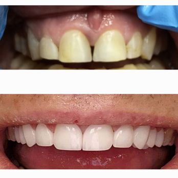 Amazing Smile Dentistry - Smile makeover with Veneers - General Dentistry Near Me - Las Vegas, Nevada Amazing Smile Dentistry - Smile makeover with Veneers - General Dentistry Near Me - Las Vegas, Nevada
