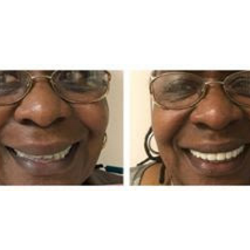 Empire Dental Group of New Jersey - Full Mouth Restoration