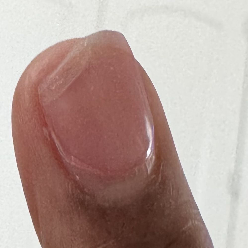 Broken nail after 1 week. Broken nail after 1 week.