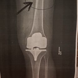 Sierra Pacific Orthopedics