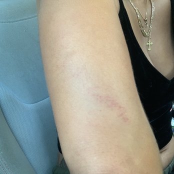 Gainesville Police Department - Bruises caused by violent bouncer - Police Departments Near Me - Gainesville, Florida Gainesville Police Department - Bruises caused by violent bouncer - Police Departments Near Me - Gainesville, Florida
