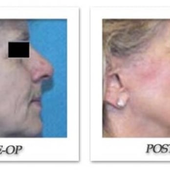Beverly Hills Physicians - Cosmetic Surgeons Near Me - Oxnard, California Beverly Hills Physicians - Cosmetic Surgeons Near Me - Oxnard, California