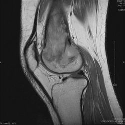 Opensided MRI of Denver - State-of-the-art imaging - NO TUBE