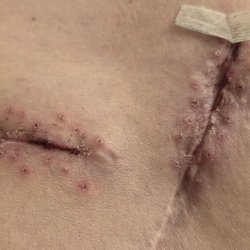 Lakeside Orthopedic Institute
