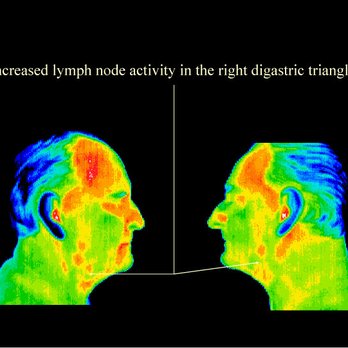Wholistic Thermography - Diagnostic Imaging Near Me - Johnstown, Pennsylvania Wholistic Thermography - Diagnostic Imaging Near Me - Johnstown, Pennsylvania