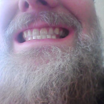 Alla Aver, DDS - Clean teeth! - Cosmetic Dentists Near Me - Glenview, Illinois