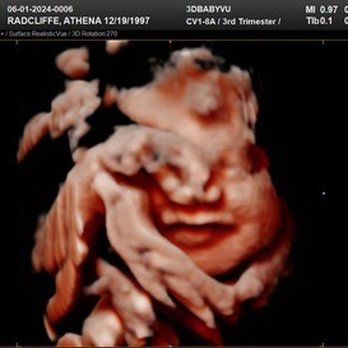 3DBabyVu - Baby - Ultrasound Imaging Centers Near Me - Pleasanton, California