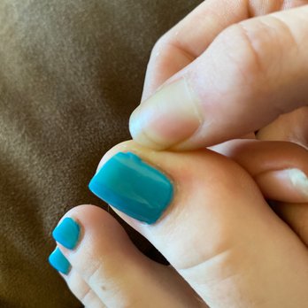 Stellar Nail Spa - Large clumps such as the one above on multiple toes. - Nail Salons Near Me - Rohnert Park, California Stellar Nail Spa - Large clumps such as the one above on multiple toes. - Nail Salons Near Me - Rohnert Park, California