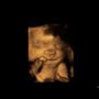 Photo of Babyview 3D/4D Ultrasounds