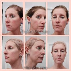Sinfully Beautiful - Skin care is so important not just procedures