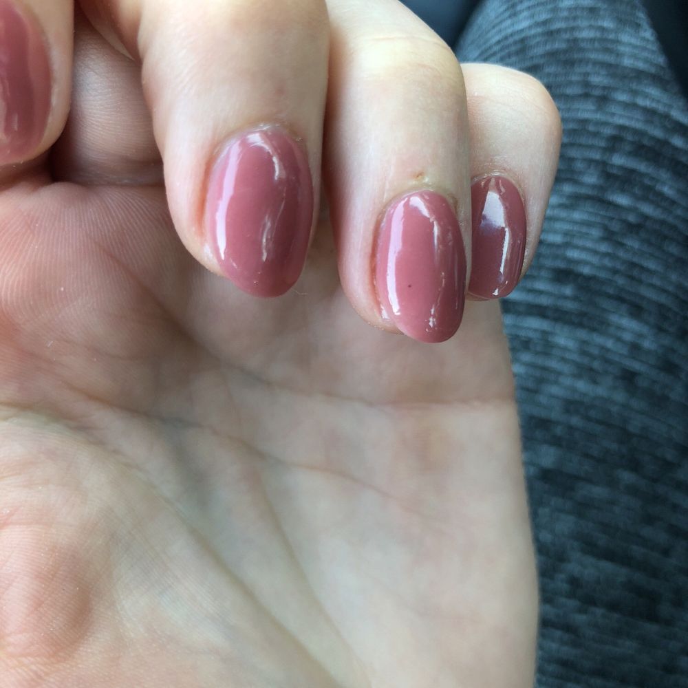 Dark dot on my nail that was not fixed