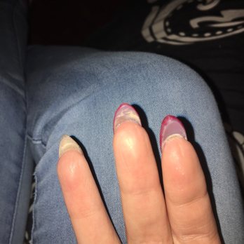 SalonSpa - My real nails were not trimmed underneath, you can also see how thick the top of my ring finger nail is compared to my other two - Hair Salons Near Me - Tumwater, Washington SalonSpa - My real nails were not trimmed underneath, you can also see how thick the top of my ring finger nail is compared to my other two - Hair Salons Near Me - Tumwater, Washington