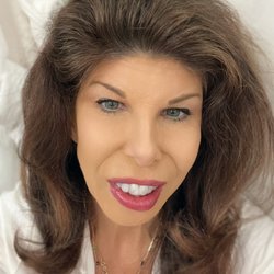 Goeckner & Gibbons Orthodontics - Another picture of my teeth with the aligners