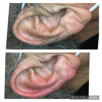 Skin care by Joanna - Ear waxing for men - Skin Care Near Me - Wappingers Falls, New York Skin care by Joanna - Ear waxing for men - Skin Care Near Me - Wappingers Falls, New York