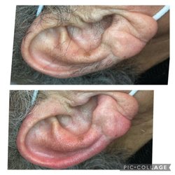 Skin care by Joanna - Ear waxing for men