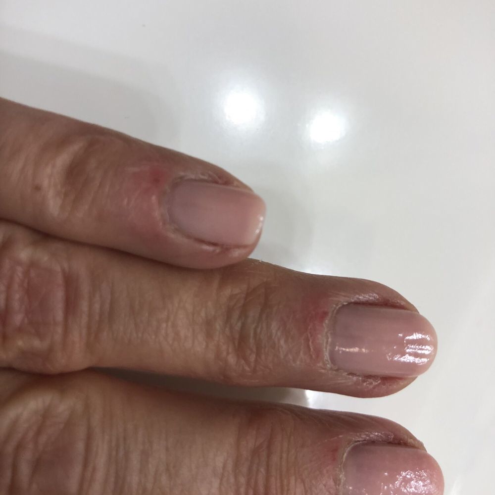 Manicure gone bad. Manicure gone bad.