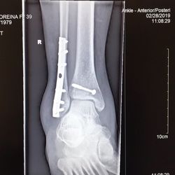 Fort Lauderdale Orthopaedics & Sports Medicine
