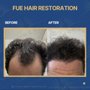 Concord Hair Restoration