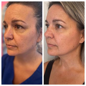 Salt Boutique Labs - Regenerative aesthetics
Enhancing and turning back the time - Medical Spas Near Me - Wappingers Falls, New York Salt Boutique Labs - Regenerative aesthetics
Enhancing and turning back the time - Medical Spas Near Me - Wappingers Falls, New York