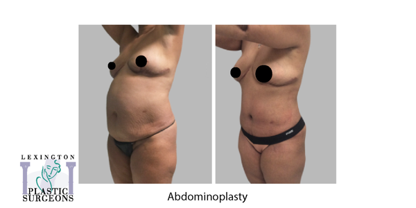 Lexington Plastic Surgeons