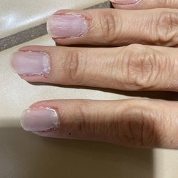 3 middle fingers have areas that were knicked with drill and bleeding.