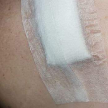 Adaniya Matthew S MD - Surgery was quick & easy....less than an hour. - Cosmetic Surgeons Near Me - Honolulu, Hawaii Adaniya Matthew S MD - Surgery was quick & easy....less than an hour. - Cosmetic Surgeons Near Me - Honolulu, Hawaii