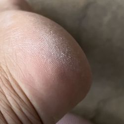 Nails Loft - The callous not removed and heels are dry.