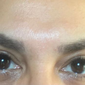Unique Lashes - My eyes were irritated all night. I asked fir volume she showed me pictures that didn't even compare to what this looks like!! Smh - Eyelash Service Near Me - Brea, California Unique Lashes - My eyes were irritated all night. I asked fir volume she showed me pictures that didn't even compare to what this looks like!! Smh - Eyelash Service Near Me - Brea, California