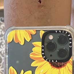 When I took off the steri strips after 3 days. After my two previous Nexplanon insertions, I never had a cut this size. When I took off the steri strips after 3 days. After my two previous Nexplanon insertions, I never had a cut this size.