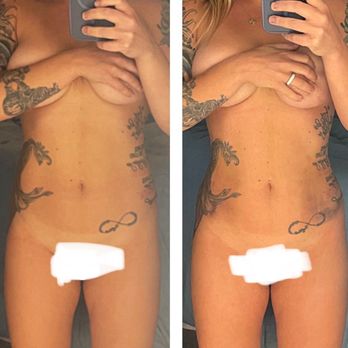 Port City Plastic Surgery - Plastic Surgeons Near Me - North Charleston, South Carolina