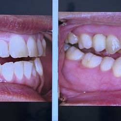 TruDental - Successful implant process