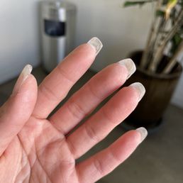 Hurt my hands and skin