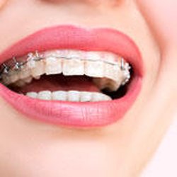 Bear Creek Dentistry & Orthodontics