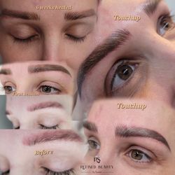 Refined Beauty By Suwan - Correction Brow for the first session, healed after 6 weeks and touch-up right after.
