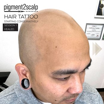 Pigment2scalp Micropigmentation - With Pigment2scalp, SMP treatments are done over 3 sessions for more realistic results with dimension; rather than just a single shade. - Hair Loss Centers Near Me - San Diego, California Pigment2scalp Micropigmentation - With Pigment2scalp, SMP treatments are done over 3 sessions for more realistic results with dimension; rather than just a single shade. - Hair Loss Centers Near Me - San Diego, California