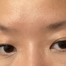 Before Before
