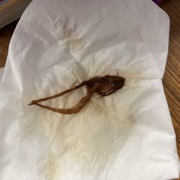 Slimy and goopy tea sediment that was in our Whataburger tea. Slimy and goopy tea sediment that was in our Whataburger tea.