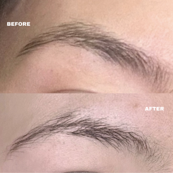 Affordable Laser - Medical Spas Near Me - Broomfield, Colorado Affordable Laser - Medical Spas Near Me - Broomfield, Colorado