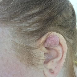 Before surgery