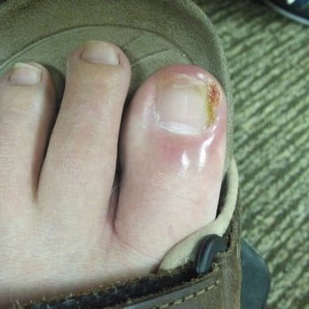 Joseph Cortez, DPM - He shouldn't even be called a Dr.... - Podiatrists Near Me