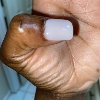 Lovely Nails - My nail damaged - Nail Salons Near Me - Irving, Texas