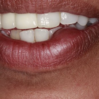 Randy Fong, DDS - Oral Surgeons Near Me - Santa Ana, California Randy Fong, DDS - Oral Surgeons Near Me - Santa Ana, California