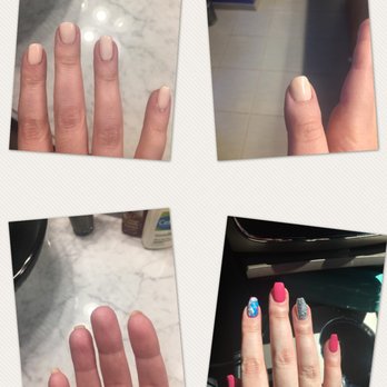 Treuvis Med Spa - Bottom right were my real nails before I went to this awful place. They filed them so low I ended up with the nubs pictured above. - Eyelash Service Near Me - Clinton Township, Michigan Treuvis Med Spa - Bottom right were my real nails before I went to this awful place. They filed them so low I ended up with the nubs pictured above. - Eyelash Service Near Me - Clinton Township, Michigan