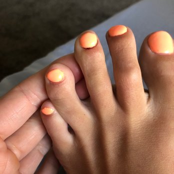 Bellagio Nail - One of the toes that is still bleeding - Nail Salons Near Me - Orem, Utah