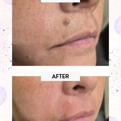 Plush Derma